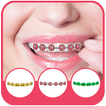 ”Braces Photo Montage Pro