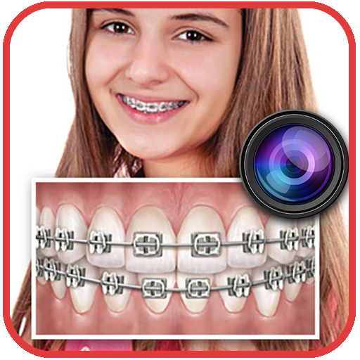 Braces Teeth Booth