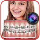 Braces Teeth Booth APK