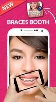 Braces Teeth Booth Affiche