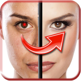 APK Red Eye Remover