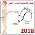 Icona ضعف الإنتصـاب الأسباب والعلاج