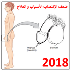 ضعف الإنتصـاب الأسباب والعلاج иконка
