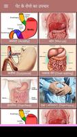 पेट के रोगो का उपचार Ekran Görüntüsü 1