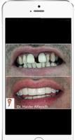 Ceram Dental screenshot 3