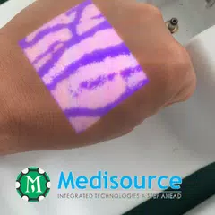 Vein Finder Device