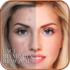 Face Blemishes Removal MOD