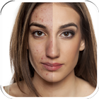 Pimple Eraser Photo Editor ikona