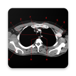 POCKET ATLAS CT THORAX