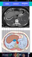 POCKET ATLAS CT THORAX ảnh chụp màn hình 1