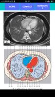 POCKET ATLAS CT THORAX ảnh chụp màn hình 2