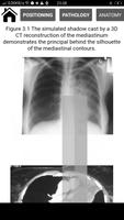 Interpretation Chest X Ray imagem de tela 3