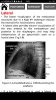 Interpretation Chest X Ray Cartaz