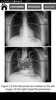 Interpretation Chest X Ray imagem de tela 1