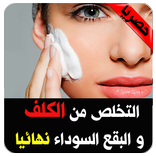 التخلص من الكلف و البقع السوداء نهائيا💯