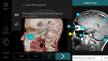 Human Anatomy Atlas 17 (Org.) 截图 1