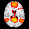 ARiBraiN APK