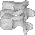 Icona Skeletal Dysplasia View: Spine