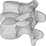 Skeletal Dysplasia View: Spine icône