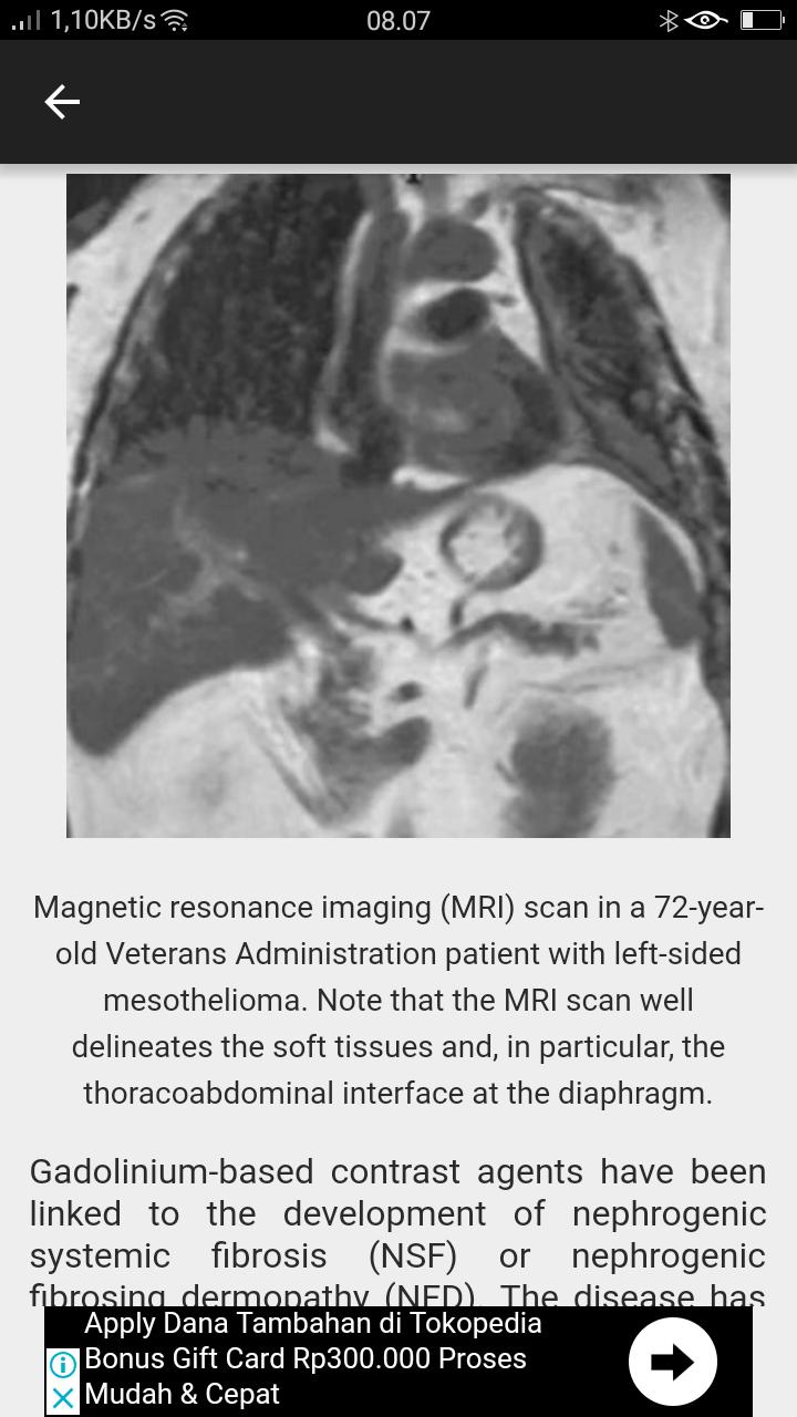 end of life stages of mesothelioma