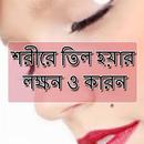 শরীরে তিল হওয়ার লক্ষন ও কারন APK