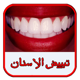 تبييض الأسنان (بدون أنترنيت)