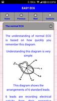 Easy ECG تصوير الشاشة 2