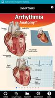 Signs & Symptoms Arrhythmia capture d'écran 1