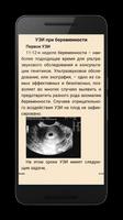 Беременность Зачатие и Роды capture d'écran 1