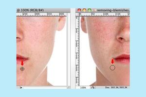 1 Schermata Face Blemishes Removal