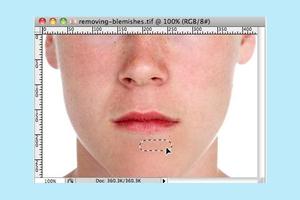 2 Schermata Face Blemishes Removal