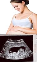 Ultrasound Scanner poster