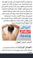 علاج سريع للبهاق طبيعيا Cartaz