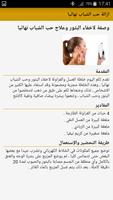 ازالة حب الشباب نهائيا Screenshot 3