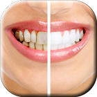 تبييض الاسنان بوصفات منزلية-icoon