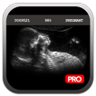 Pregnancy Test Simulator