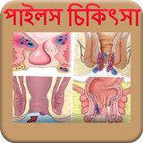 পাইলস হলে করণীয় - Piles Treatment Zeichen