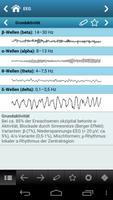 Epilepsie pocketcards screenshot 3