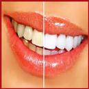 естественное отбеливание зубов APK