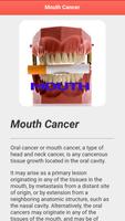 Mouth Cancer 截圖 3