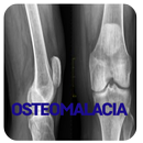 Osteomalacia Disease APK