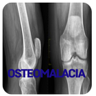 Osteomalacia Disease icône