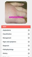 2 Schermata Angioedema Disease