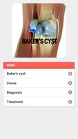 Baker's cyst Disease 截圖 1