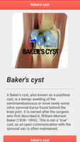 Baker's cyst Disease 截圖 2