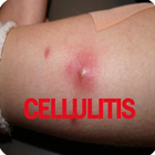 Cellulitis Infection icon