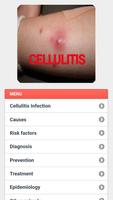 Cellulitis Infection screenshot 2