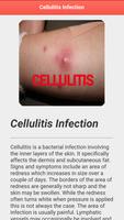Cellulitis Infection screenshot 3