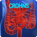 Crohns Disease APK
