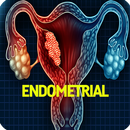 Endometrial Cancer APK